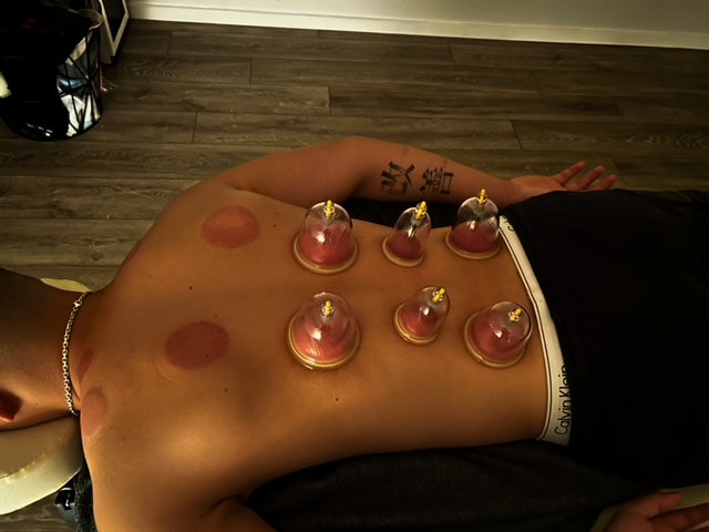 Cupping Massage